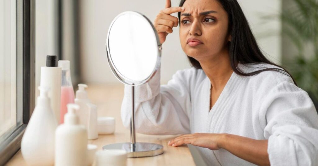 dark spot treatment in indore