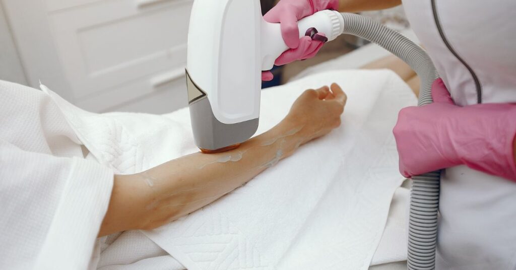 Laser hair removal treatment in indore for safe and permanent hair reduction on face and body