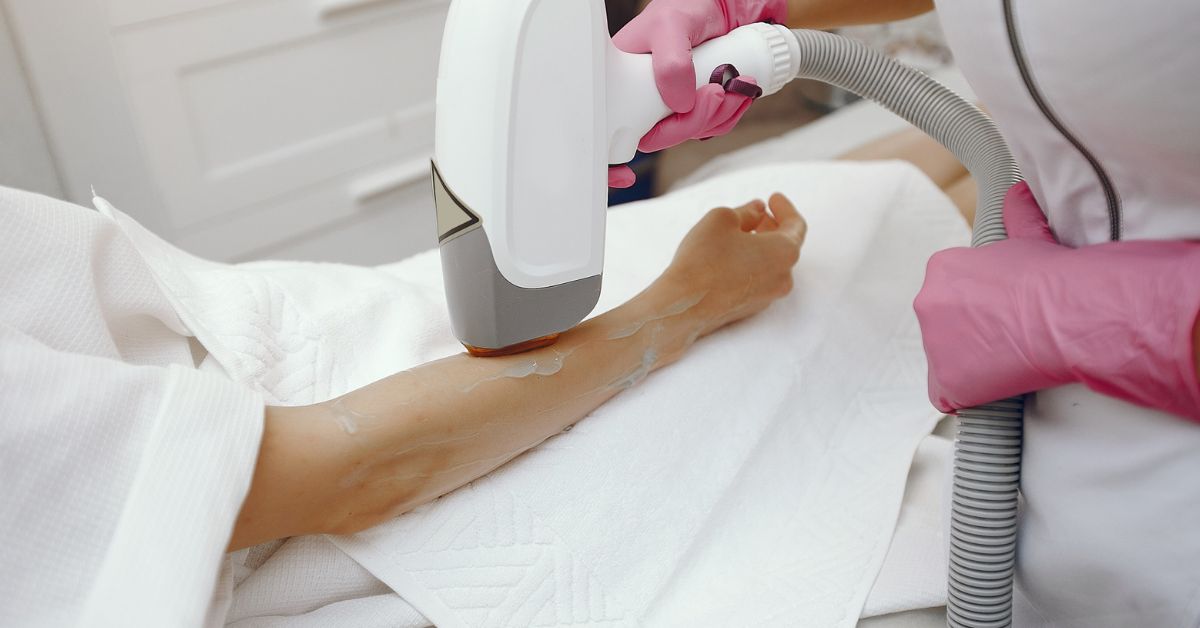 Laser hair removal treatment in indore for safe and permanent hair reduction on face and body