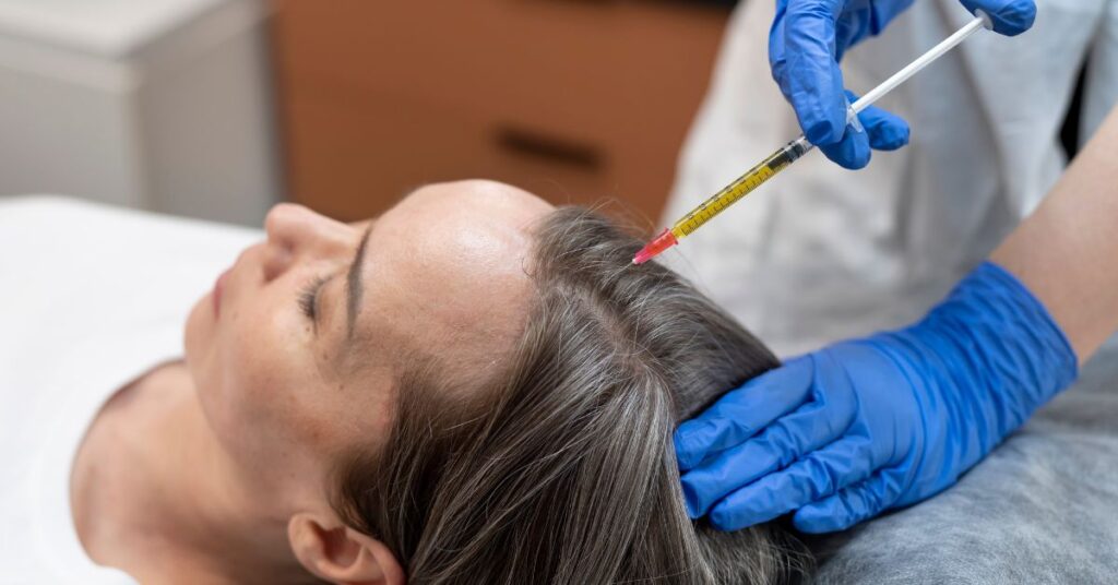 PRP hair therapy in indore