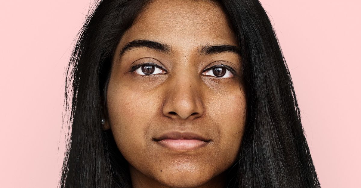 Melasma treatment in Indore with skin brightening treatment in Indore for reducing pigmentation and improving skin tone